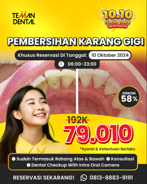 Perawatan Karang Gigi